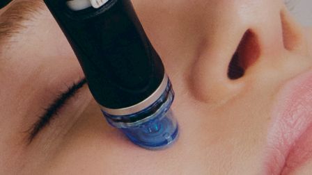 A close-up of a person receiving a skincare treatment on the face with a device featuring a blue attachment.